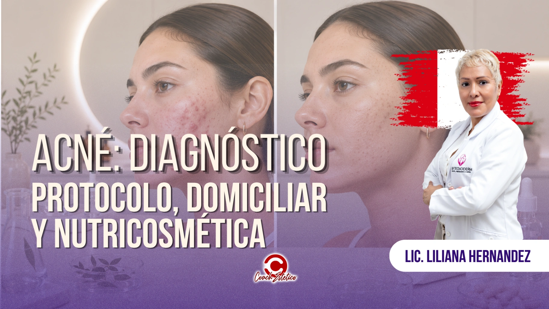 Módulo 07 — Acné: diagnóstico, protocolo, domiciliar y nutricosmética